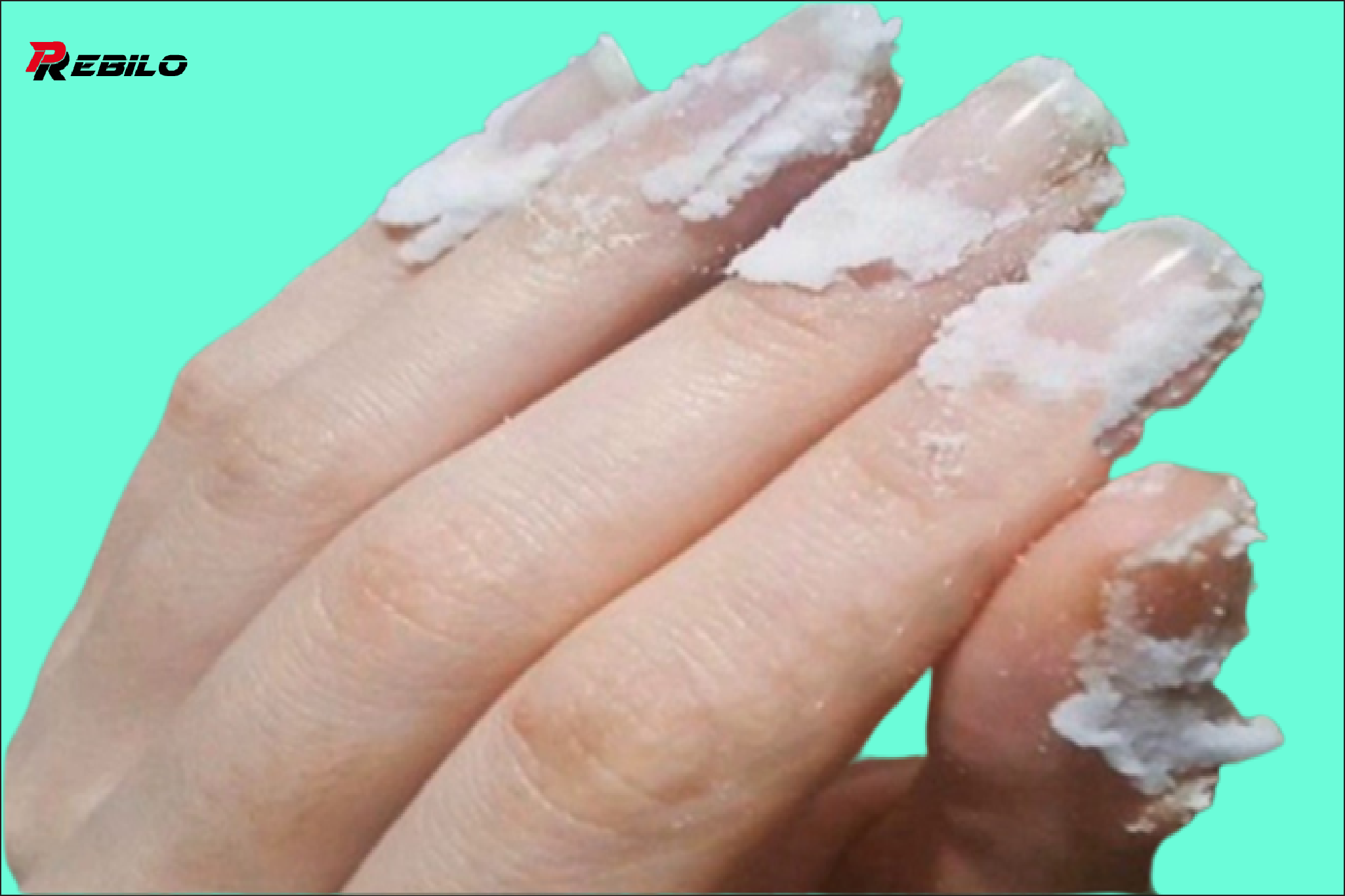 Rub some baking soda on your nails and see what happens? This trick will change your life