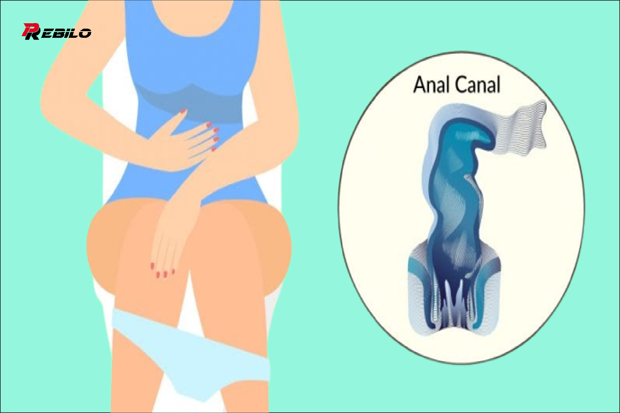 5 early warning signs of anal cancer