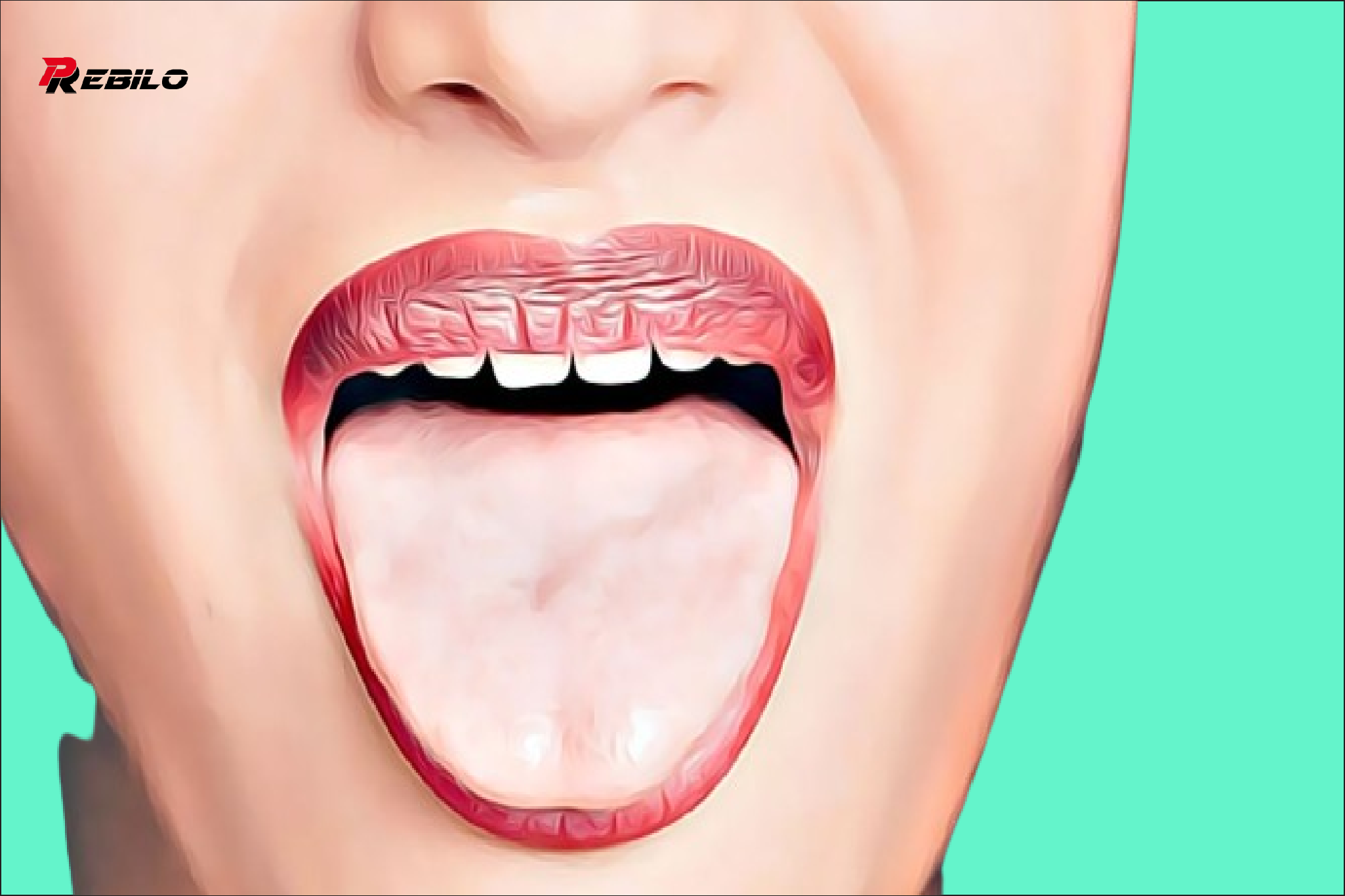 What Does Your Tongue Say About Your Health Page 2
